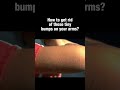 How To Treat Those Tiny Bumps On Your Arms Skincare Skincareadvice Bodycare Skincareroutine