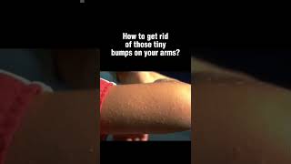 How to treat those tiny bumps on your arms #skincare #skincareadvice  #bodycare  #skincareroutine