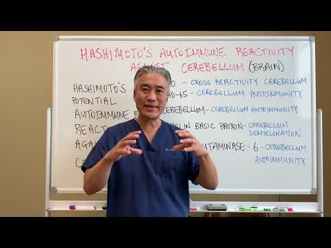 Understanding Thyroid Dysfunction Hashimoto s Part 1 Signs and Symptoms