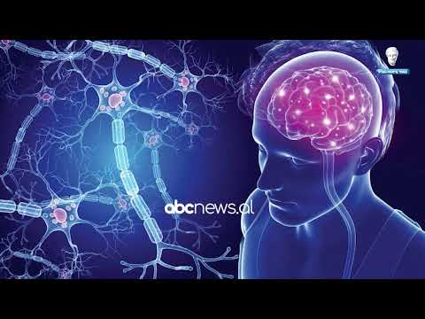 Skleroza multiple/ Spitali Hygeia pjesë e një studimi botëror mbi këtë sëmundje | ABC News Albania