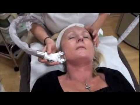 LPG Liftmassage - Non-Surgical Facelift at Body Silk Clinic London