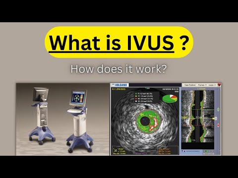 What is IVUS (Intra Vascular Ultrasound) & How does it work?