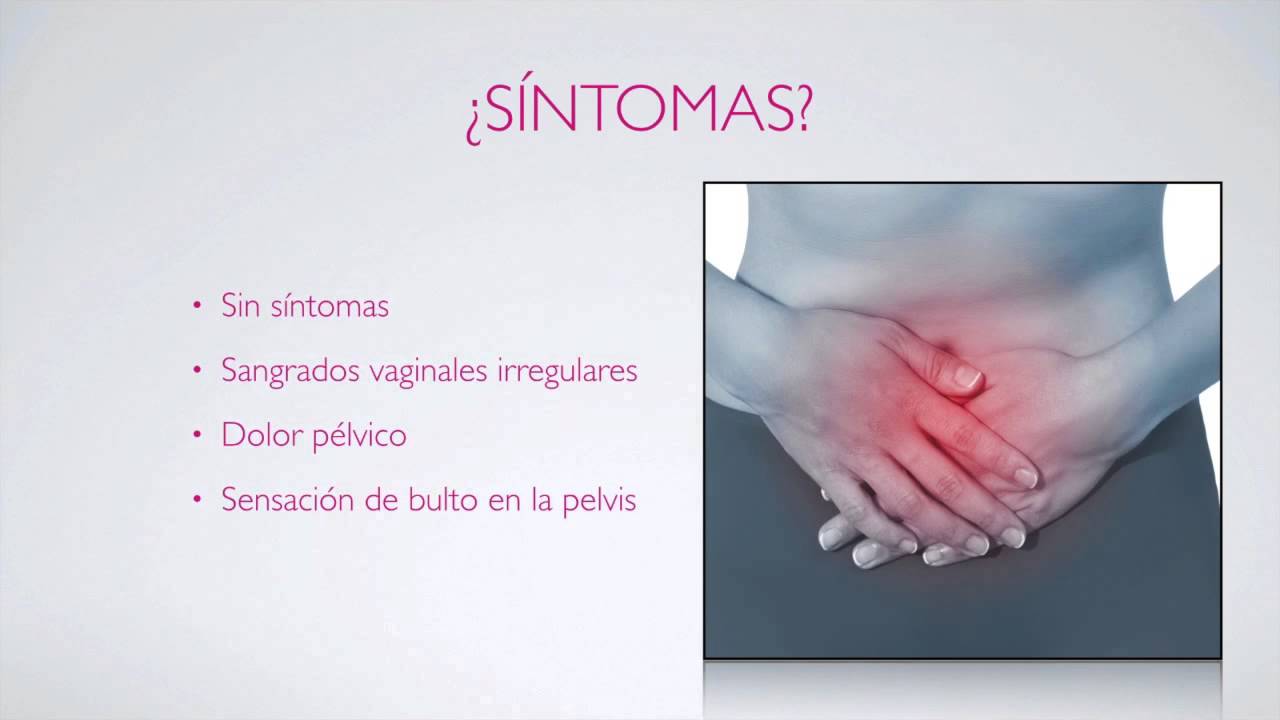 Jesús Arturo Moyers Arevalo-12