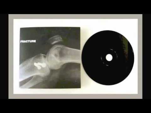 FRACTURE - 