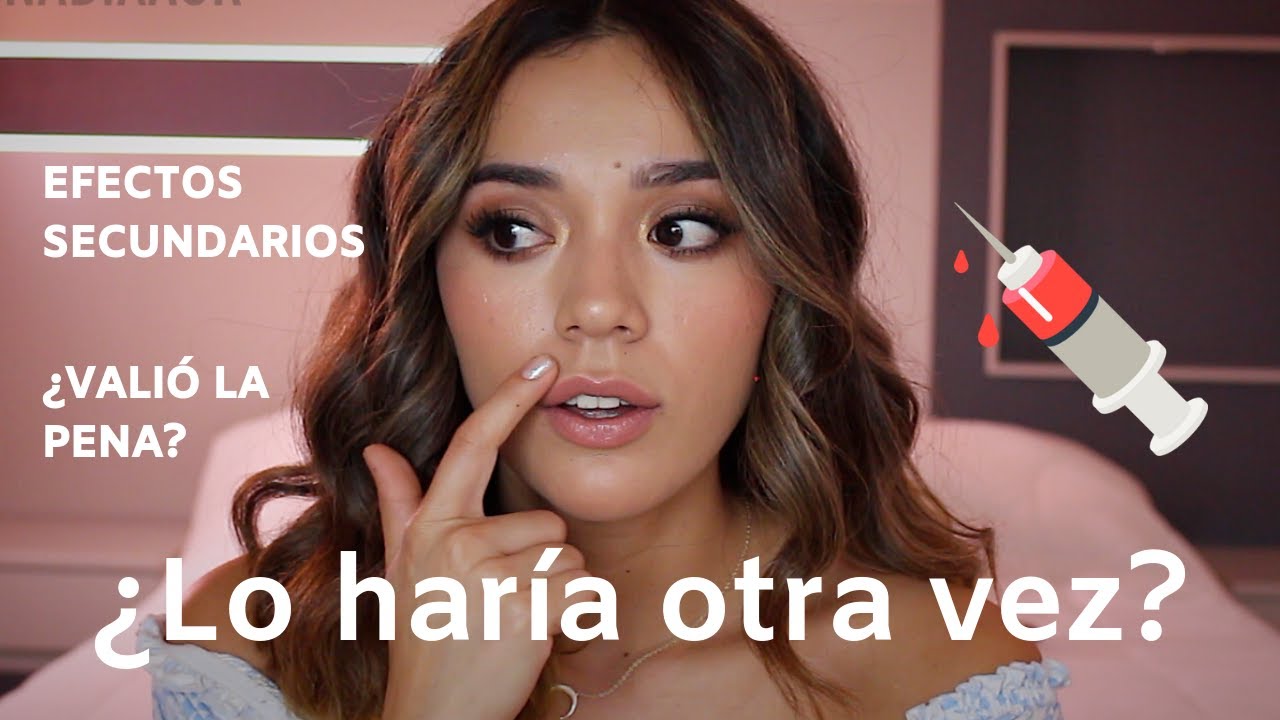 ¡MI EXPERIENCIA DESPUÉS DE UNA RINOMODELACIÓN!