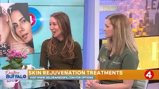 Daytime Buffalo: Selora Med Spa skin rejuvenation treatments | Sponsored Segment