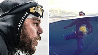 HE SPENT 157 DAYS SWIMMING IN THE OPEN SEA! LOOK WHAT HAS BECOME OF HIM