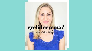Eyelid Eczema? We can help!