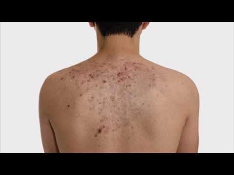 Лейкоциты в мазке болит поясница Ужасные боли в костях спины
