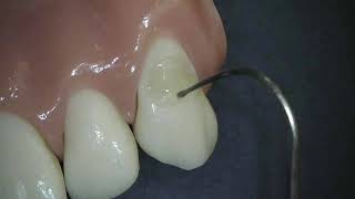 Dr. Robert Marus Demos G-ænial™ Universal Injectable & everX Flow™