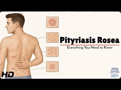 Is Pityriasis Rosea Contagious? Separating Fact from Fiction 🤔