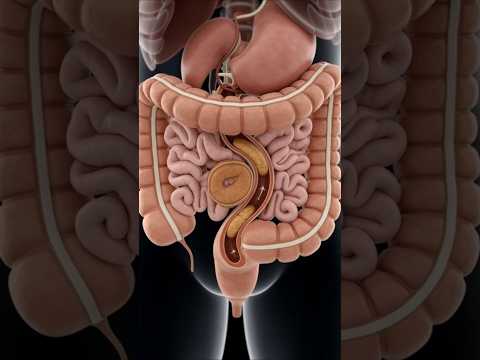 How Stool Moves Through the Intestine 💩 | Digestive System 3D Animation #shorts