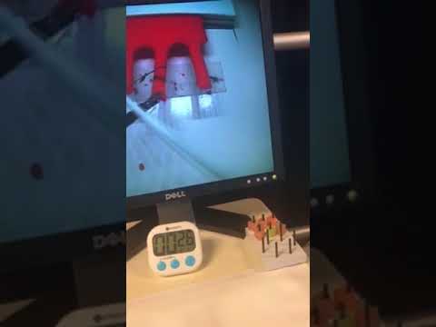 Laparoscopic ligating loop