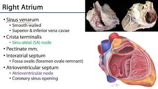 Right Atrium