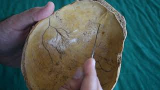 Osteology of Skull Cap- calvarium