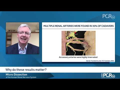 Nerve Injury & Regrowth after RDN in Swine Model - Micro Dissection of Human Renal Nervous System