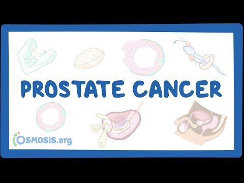Prostatitis und wie lechit Prostata und Blase Ultraschall Restharn