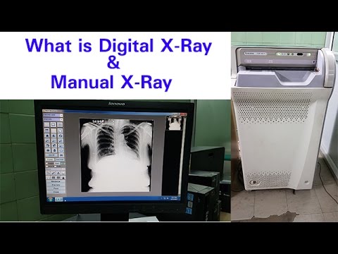 X Ray Machine