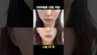 쥬베룩볼륨으로 윤곽 다듬기👊