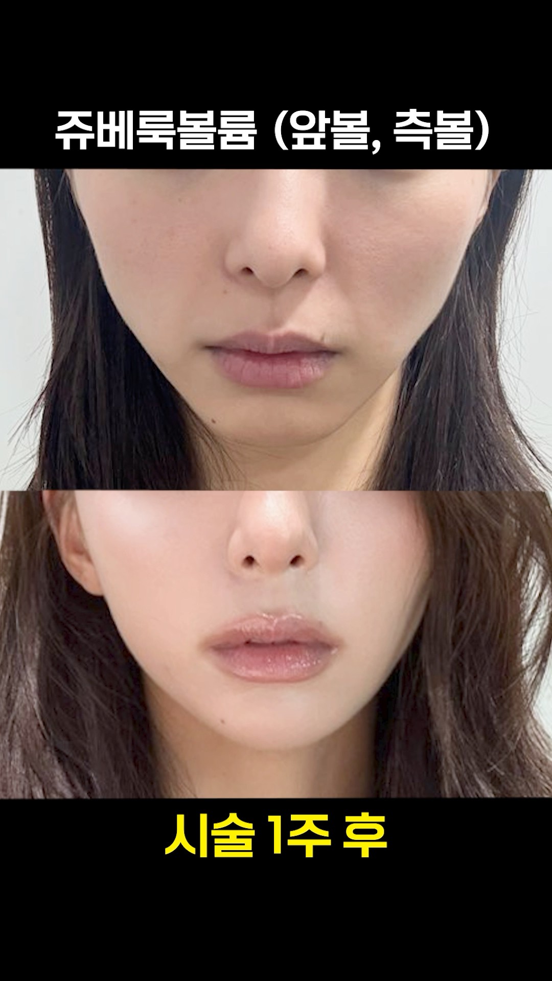 쥬베룩볼륨으로 윤곽 다듬기👊
