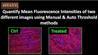 Quantify Mean Fluorescence Intensities of two different images using Manual & Auto Threshold methods
