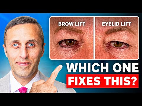 Brow Lift or Eyelid Lift: Which do YOU Need?