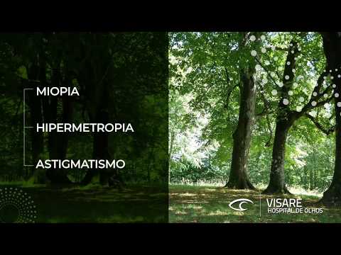 Miopia, Hipermetropia e Astigmatismo 100% a laser