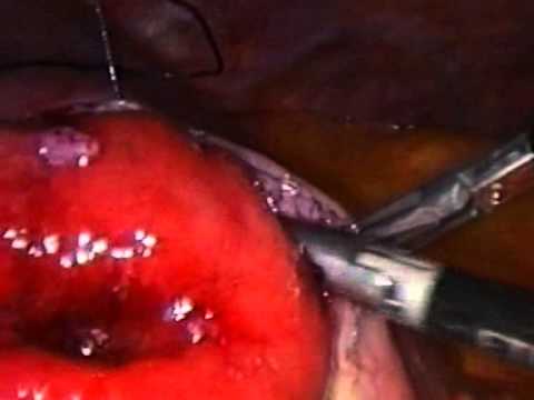 Come liberarsi da cellulite che sta al di sopra di un ginocchio Al libro del dottore di un kovalkov cresciamo magri intelligentemente