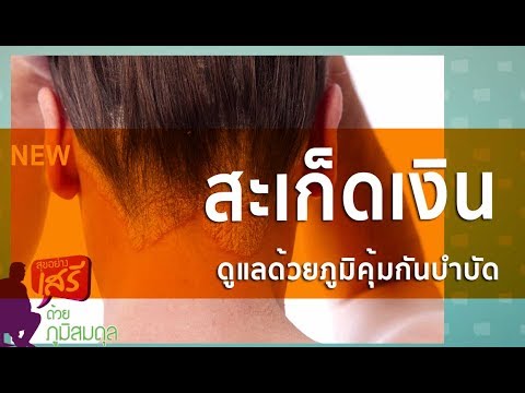 โรคสะเก็ดเงินภายใต้กล้องจุลทรรศน์ แช่ใน Amanita โรคสะเก็ดเงิน