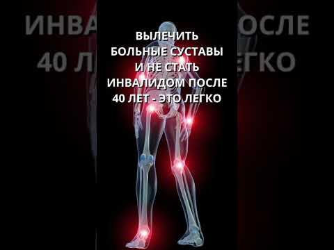 1 fokozatú coxarthrosis kezelési áttekintés