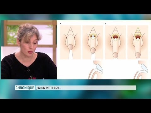 "I have a small penis," what can I do? - The Health Magazine