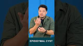 Download lagu Epididymal Cyst #drhealth #lowspermcount #maleinfertility #oligospermia #shorts #viralshorts mp3