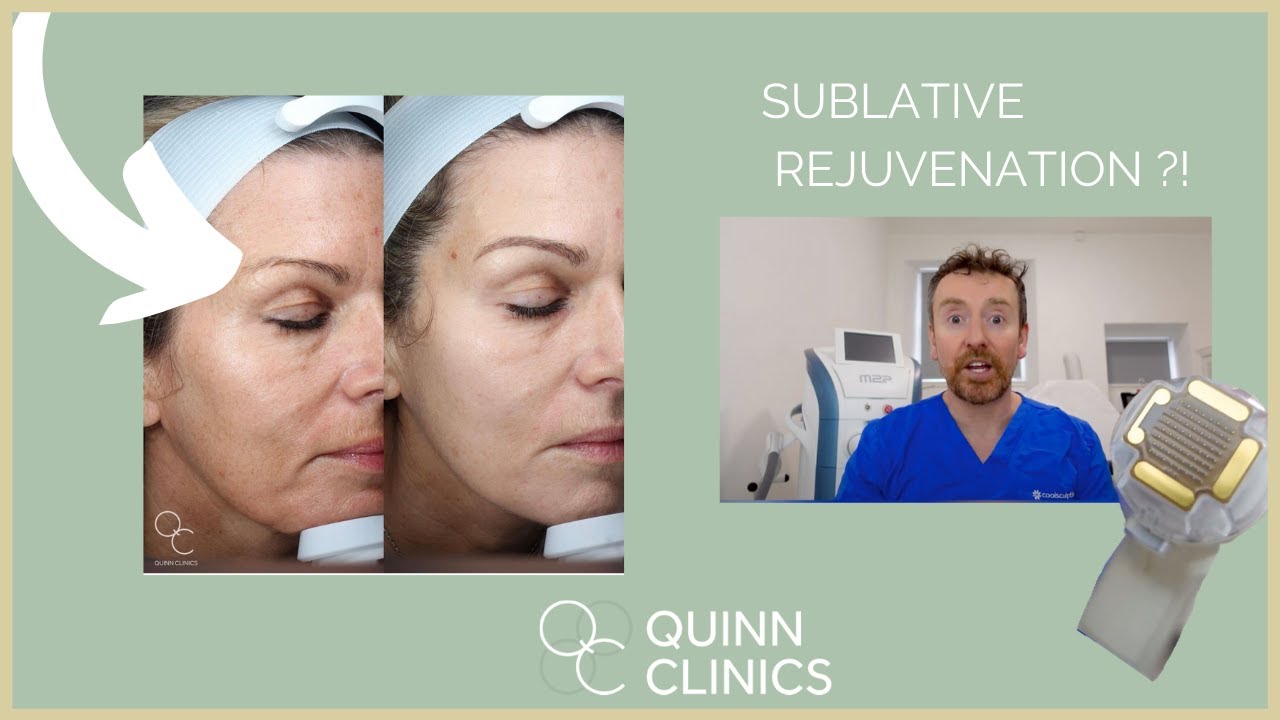 What is Sublative Rejuvenation? Dr. John Quinn Tell's All ! |  Quinn Clinics Bristol