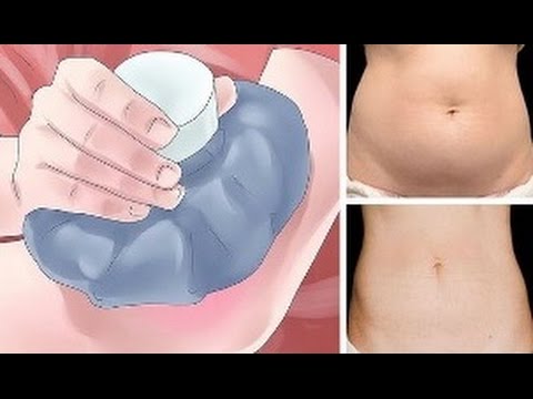 Cara menurunkan berat badan dengan pengobatan hormonal Saya kehilangan cuka anggur