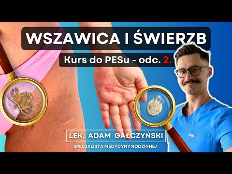 Wszawica i świerzb - jak pożegnać je na zawsze?