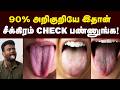 நாக்கு தான் முதல் சிக்னல் இந்த நிறம் �