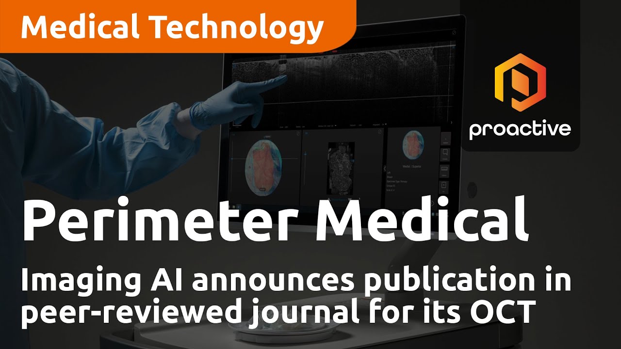 Perimeter Medical Imaging AI announces publication in peer-reviewed journal for its OCT technology