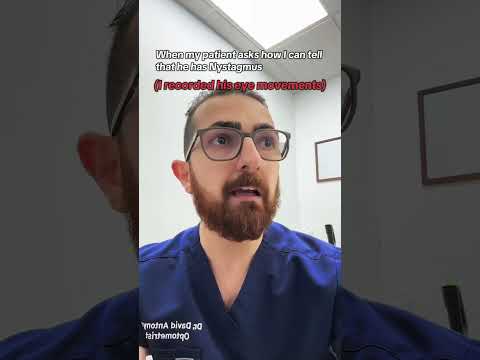 This patient has congenital nystagmus, a condition where the eyes make involuntary movements, making