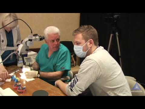 Access Refinement Focusing on the MB2: Advanced Endodontics