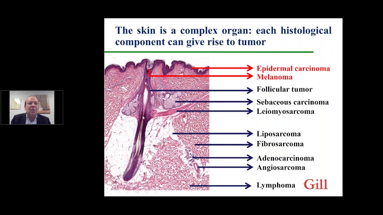 SYSF Webinar: Understanding Your Pathology Report