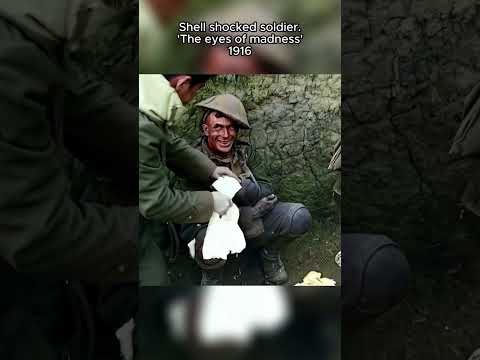 Colorized Footage: Shell shocked soldier, 1916 #ww1 #ai