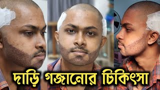 Beard Treatment | Beard Transplant | দাড়ি প্রতিস্থাপন চিকিৎসা | Hair Transplant Bangladesh