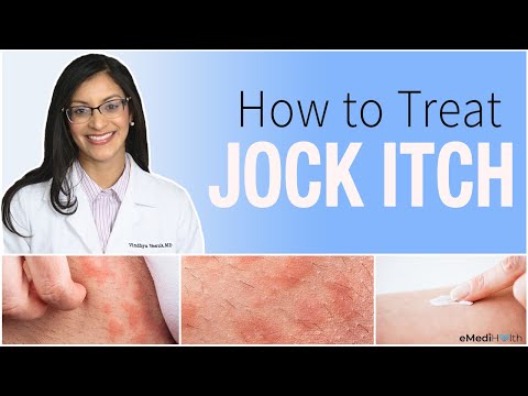 Jock Itch Treatment, Prevention, Causes, and Home Care Tips