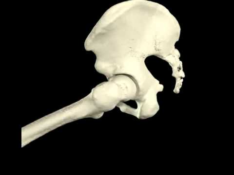 Dolore alle gambe e tirando Giorni di buon auspicio per la chirurgia del ginocchio nel mese di agosto