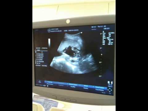 Primeiro video do caçulinha 19 semanas