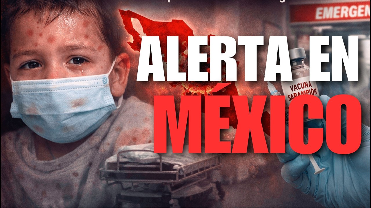 LA VERDAD del SARAMPIÓN en MÉXICO si eres MEXICANO tienes que SABER ESTO