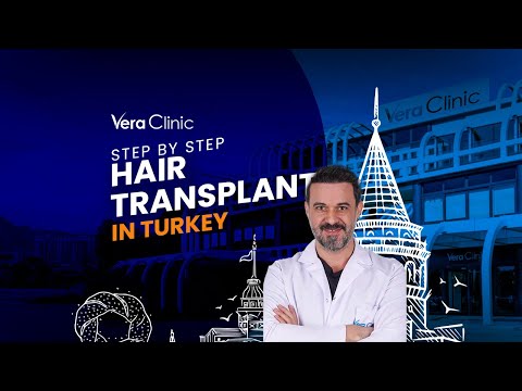 Step by Step Hair Transplant #hairtransplant #hairtransplantturkey #stepbystephairtransplant