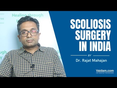 Scoliosis Surgery in India | Best explained by Dr. Rajat Mahajan