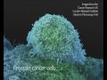 What does Cancer look like? | Cancer Research UK ...