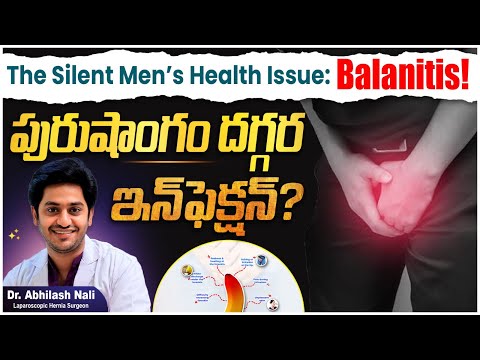 Balanitis Treatment in Telugu | Foreskin Infection in Men | Mens Wellness | Dr Abhilash Nali